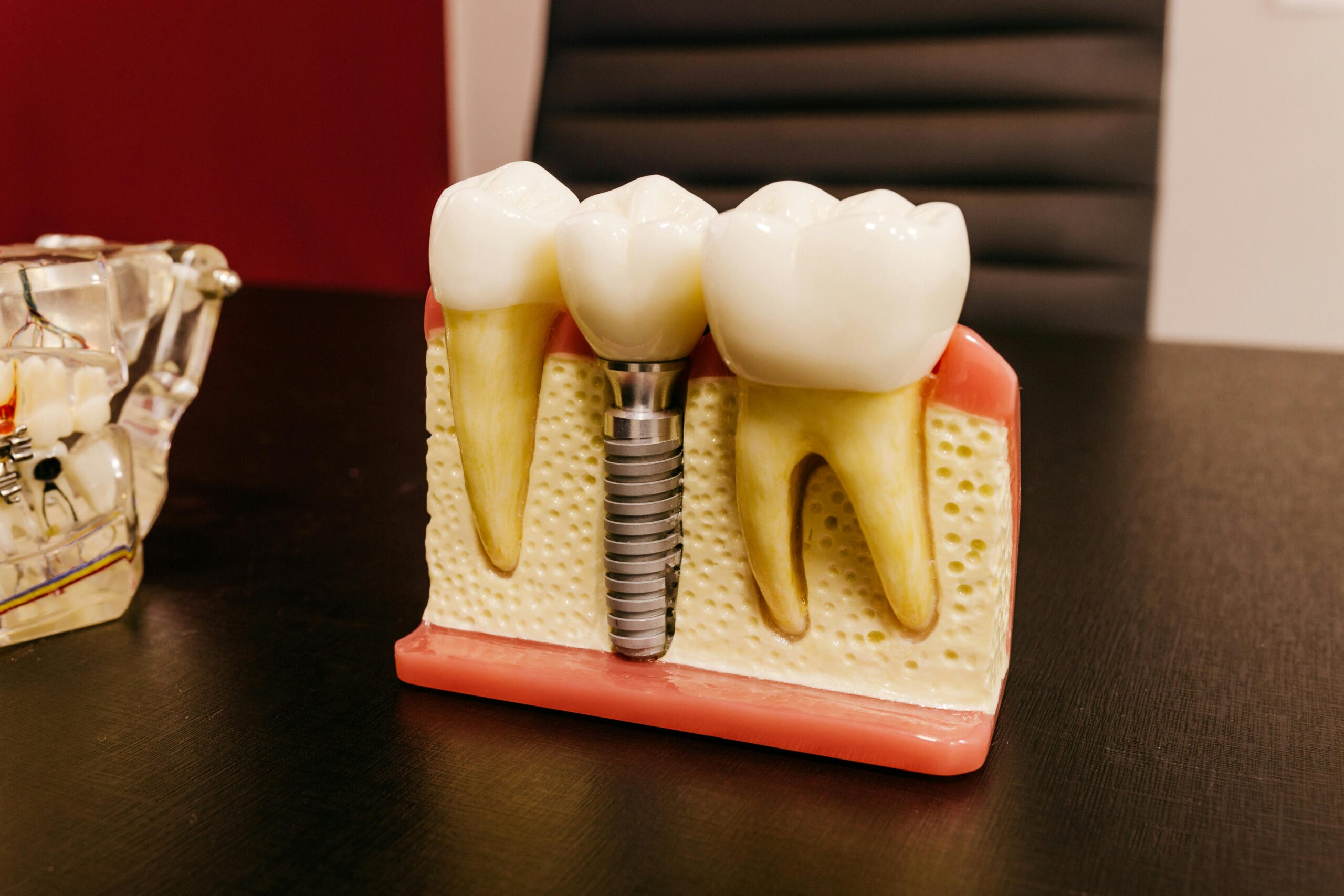 DentaImplants